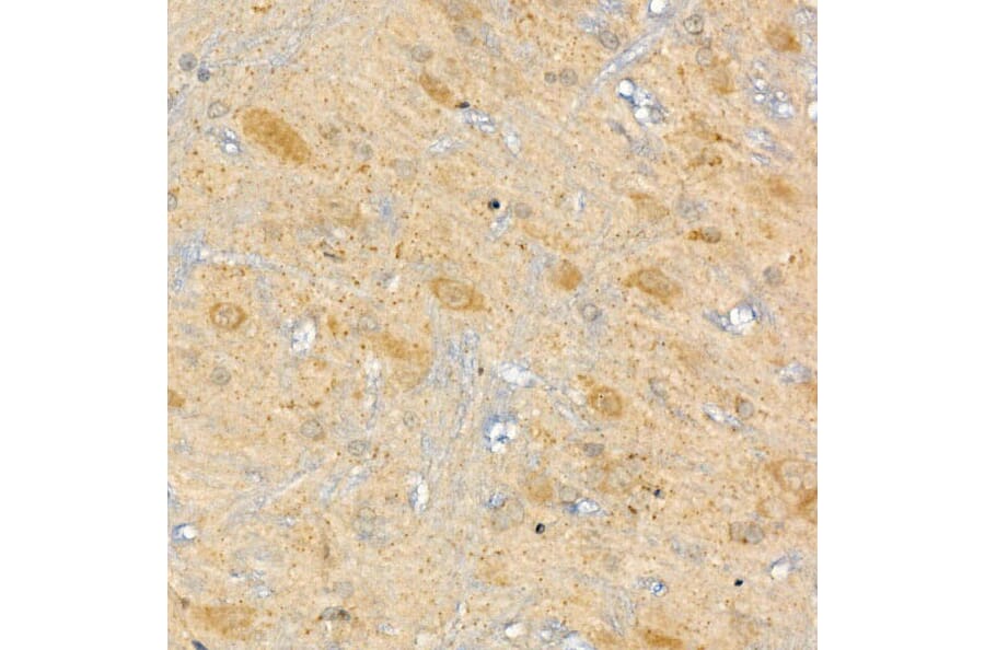 Immunohistochemistry - Anti-CPT2 Antibody (A14229) - Antibodies.com