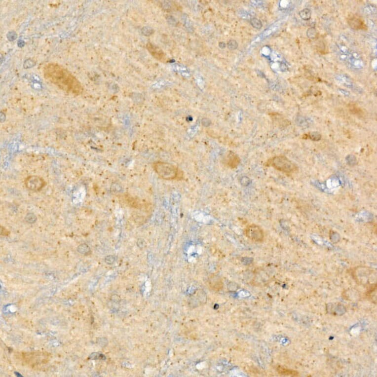 Immunohistochemistry - Anti-CPT2 Antibody (A14229) - Antibodies.com