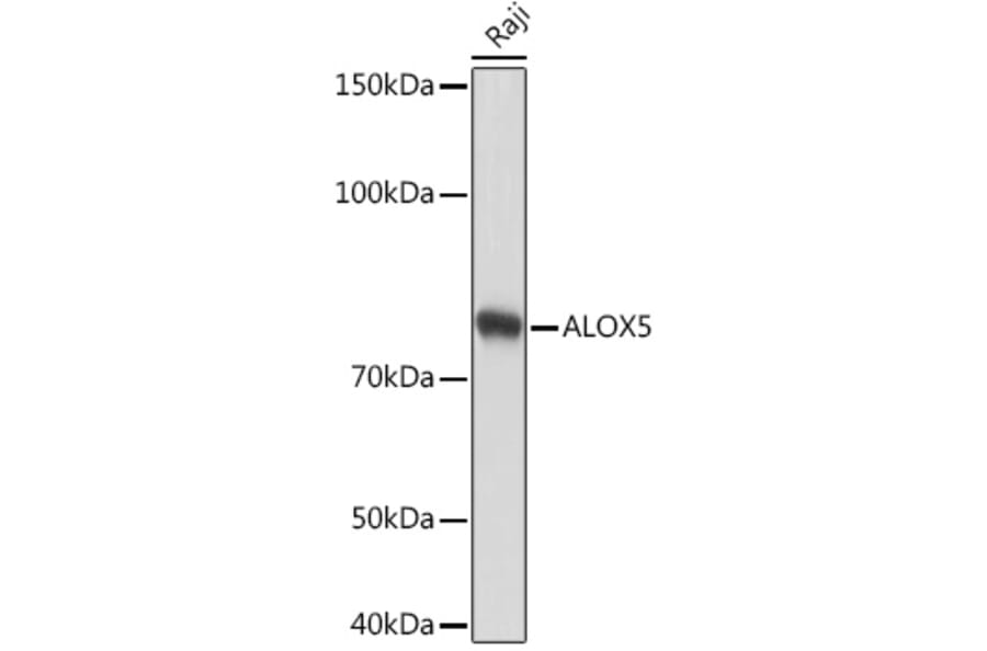 Western Blot - Anti-5 Lipoxygenase/5-LO Antibody [ARC1926] (A14230) - Antibodies.com