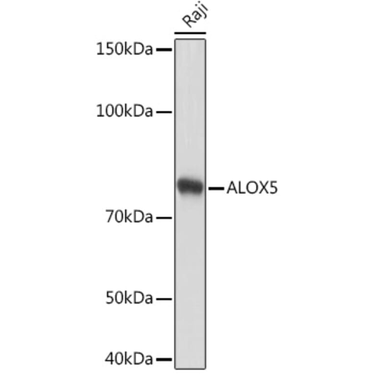Western Blot - Anti-5 Lipoxygenase/5-LO Antibody [ARC1926] (A14230) - Antibodies.com