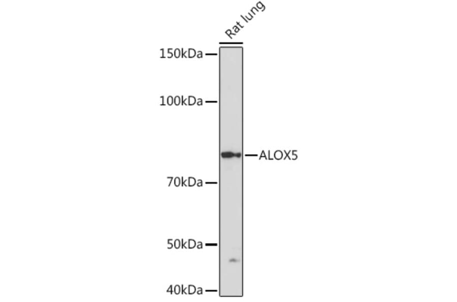 Western Blot - Anti-5 Lipoxygenase/5-LO Antibody [ARC1926] (A14230) - Antibodies.com