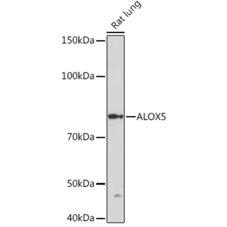 Western Blot - Anti-5 Lipoxygenase/5-LO Antibody [ARC1926] (A14230) - Antibodies.com
