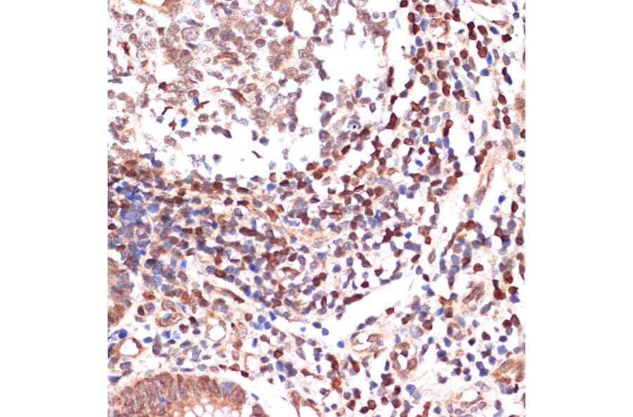Immunohistochemistry - Anti-5 Lipoxygenase/5-LO Antibody [ARC1926] (A14230) - Antibodies.com
