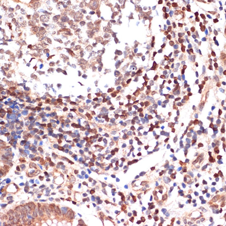 Immunohistochemistry - Anti-5 Lipoxygenase/5-LO Antibody [ARC1926] (A14230) - Antibodies.com