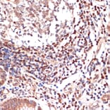 Immunohistochemistry - Anti-5 Lipoxygenase/5-LO Antibody [ARC1926] (A14230) - Antibodies.com
