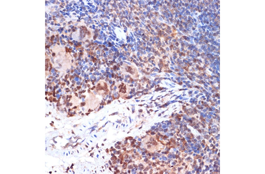 Immunohistochemistry - Anti-5 Lipoxygenase/5-LO Antibody [ARC1926] (A14230) - Antibodies.com