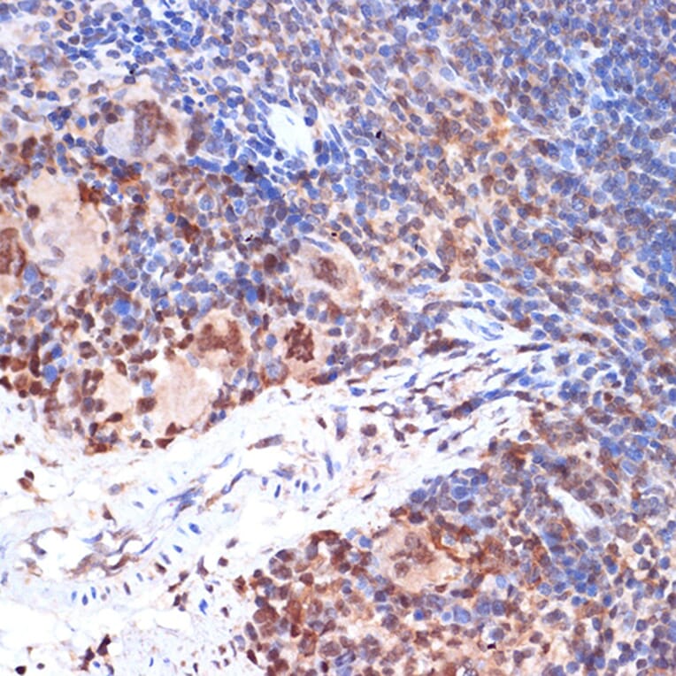 Immunohistochemistry - Anti-5 Lipoxygenase/5-LO Antibody [ARC1926] (A14230) - Antibodies.com