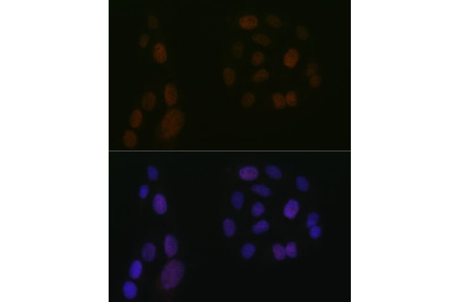 Immunofluorescence - Anti-5 Lipoxygenase/5-LO Antibody [ARC1926] (A14230) - Antibodies.com