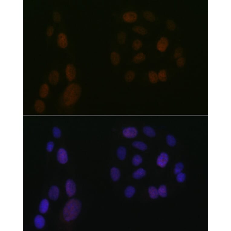 Immunofluorescence - Anti-5 Lipoxygenase/5-LO Antibody [ARC1926] (A14230) - Antibodies.com