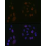 Immunofluorescence - Anti-5 Lipoxygenase/5-LO Antibody [ARC1926] (A14230) - Antibodies.com