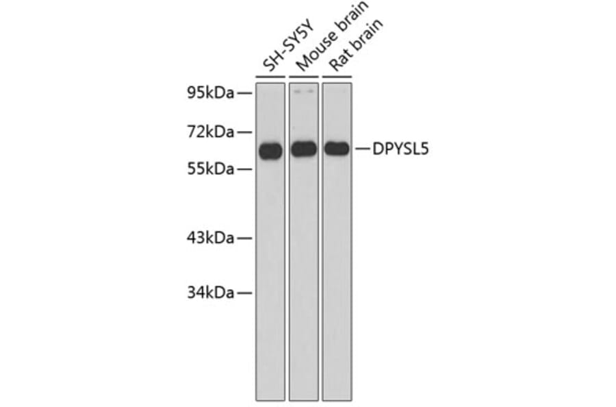 Western Blot - Anti-DPYSL5 Antibody (A2878) - Antibodies.com