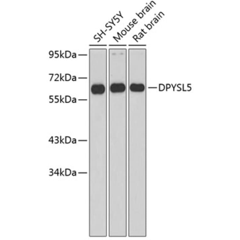 Western Blot - Anti-DPYSL5 Antibody (A2878) - Antibodies.com