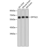 Western Blot - Anti-DPYSL5 Antibody (A2878) - Antibodies.com