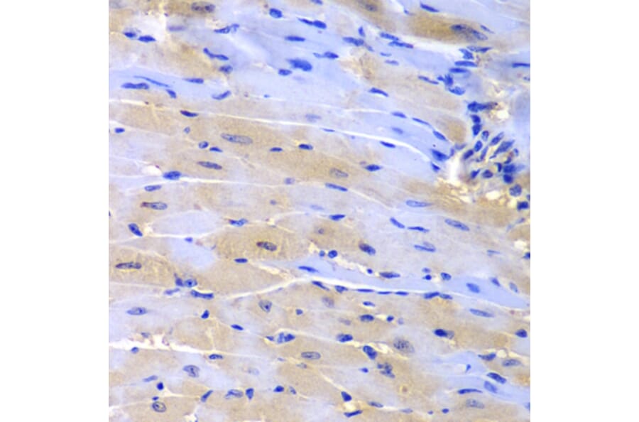 Immunohistochemistry - Anti-CUL2 Antibody (A2881) - Antibodies.com