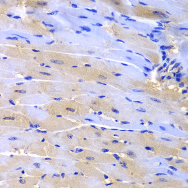 Immunohistochemistry - Anti-CUL2 Antibody (A2881) - Antibodies.com
