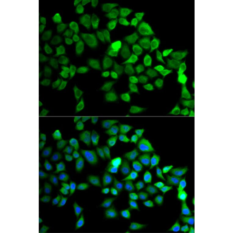 Immunofluorescence - Anti-CUL2 Antibody (A2881) - Antibodies.com