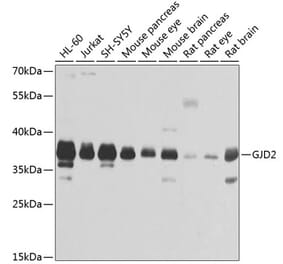 Western Blot - Anti-Cx36 Antibody (A14235) - Antibodies.com