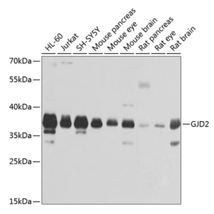 Western Blot - Anti-Cx36 Antibody (A14235) - Antibodies.com