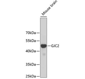 Western Blot - Anti-Cx47 Antibody (A14236) - Antibodies.com