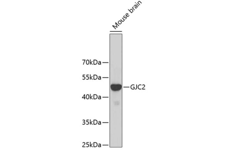 Western Blot - Anti-Cx47 Antibody (A14236) - Antibodies.com