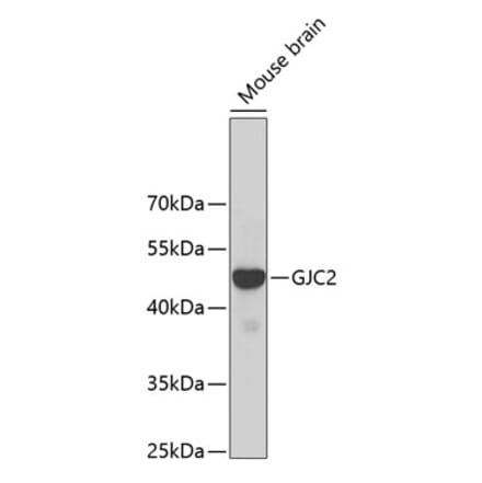 Western Blot - Anti-Cx47 Antibody (A14236) - Antibodies.com