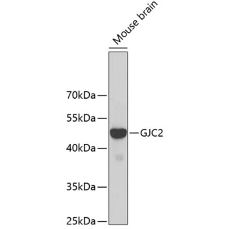 Western Blot - Anti-Cx47 Antibody (A14236) - Antibodies.com