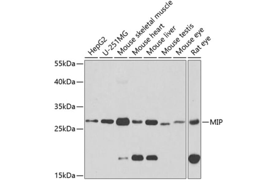 Western Blot - Anti-AQP0 Antibody (A14237) - Antibodies.com
