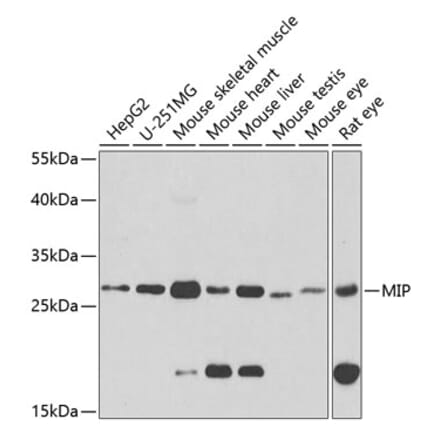 Western Blot - Anti-AQP0 Antibody (A14237) - Antibodies.com