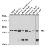 Western Blot - Anti-AQP0 Antibody (A14237) - Antibodies.com