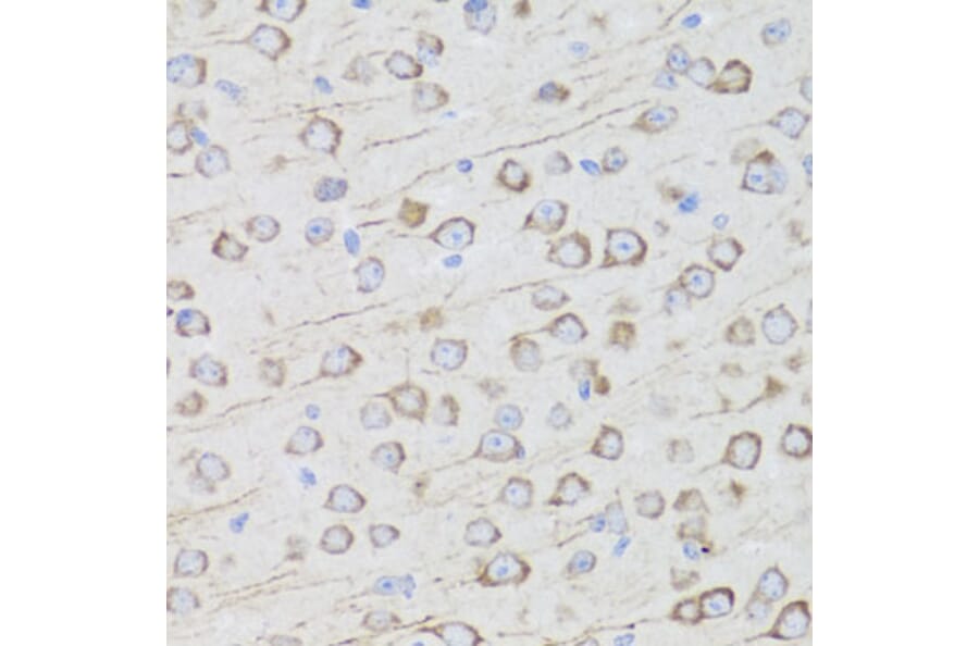 Immunohistochemistry - Anti-AQP0 Antibody (A14237) - Antibodies.com