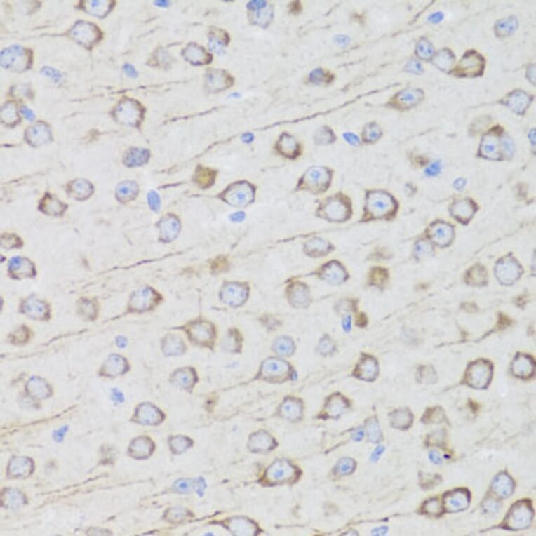 Immunohistochemistry - Anti-AQP0 Antibody (A14237) - Antibodies.com