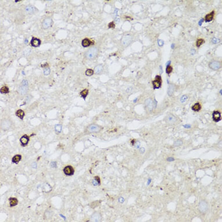 Immunohistochemistry - Anti-AQP0 Antibody (A14237) - Antibodies.com