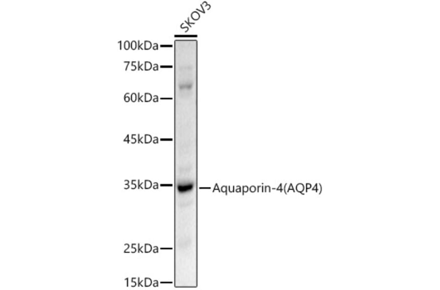Western Blot - Anti-Aquaporin 4 Antibody (A14238) - Antibodies.com