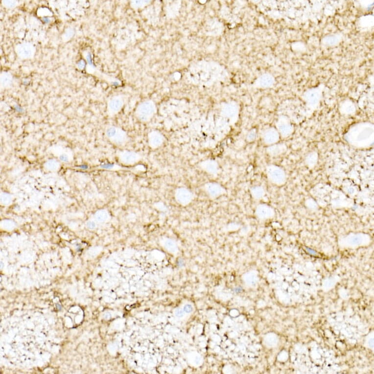 Immunohistochemistry - Anti-Aquaporin 4 Antibody (A14238) - Antibodies.com