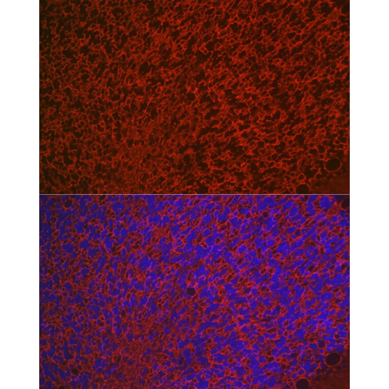 Immunofluorescence - Anti-Aquaporin 4 Antibody (A14238) - Antibodies.com