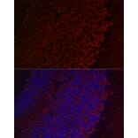 Immunofluorescence - Anti-Aquaporin 4 Antibody (A14238) - Antibodies.com