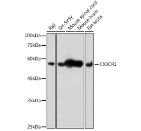 Western Blot - Anti-CX3CR1 Antibody (A14239) - Antibodies.com