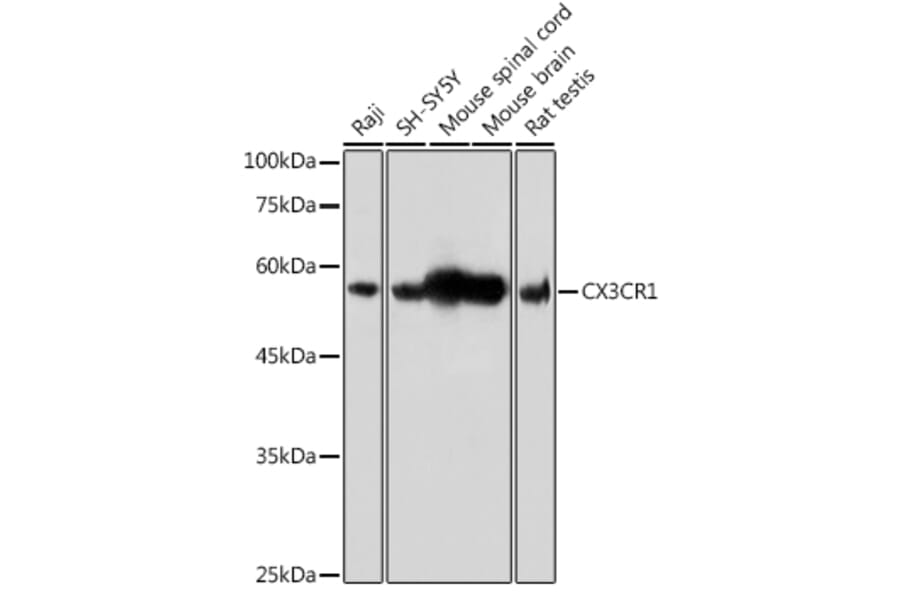Western Blot - Anti-CX3CR1 Antibody (A14239) - Antibodies.com