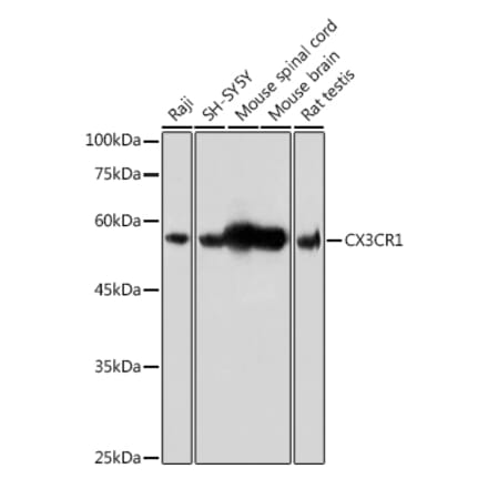 Western Blot - Anti-CX3CR1 Antibody (A14239) - Antibodies.com