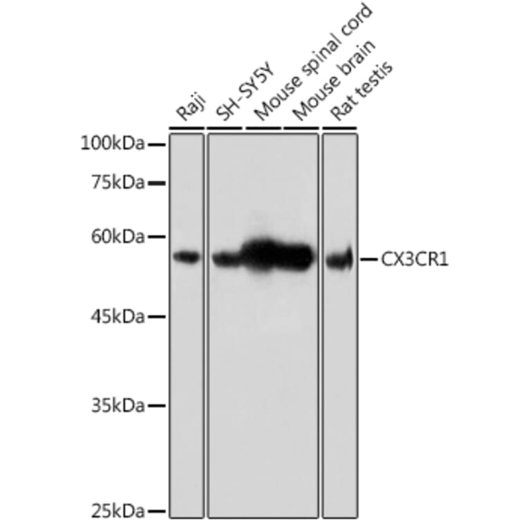 Western Blot - Anti-CX3CR1 Antibody (A14239) - Antibodies.com