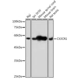 Western Blot - Anti-CX3CR1 Antibody (A14239) - Antibodies.com
