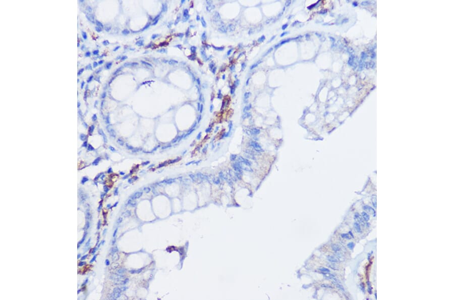 Immunohistochemistry - Anti-CX3CR1 Antibody (A14239) - Antibodies.com