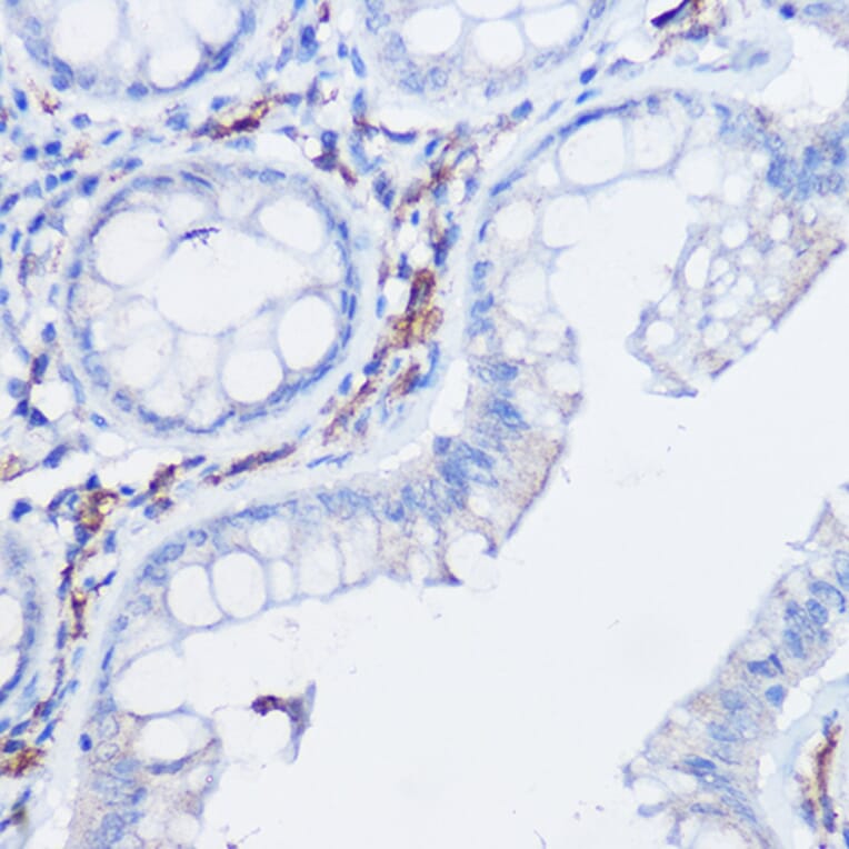 Immunohistochemistry - Anti-CX3CR1 Antibody (A14239) - Antibodies.com