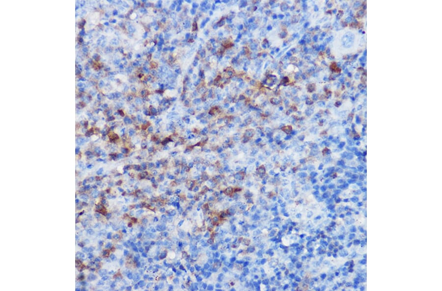 Immunohistochemistry - Anti-CX3CR1 Antibody (A14239) - Antibodies.com