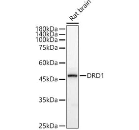 Western Blot - Anti-Dopamine Receptor D1 Antibody (A14240) - Antibodies.com