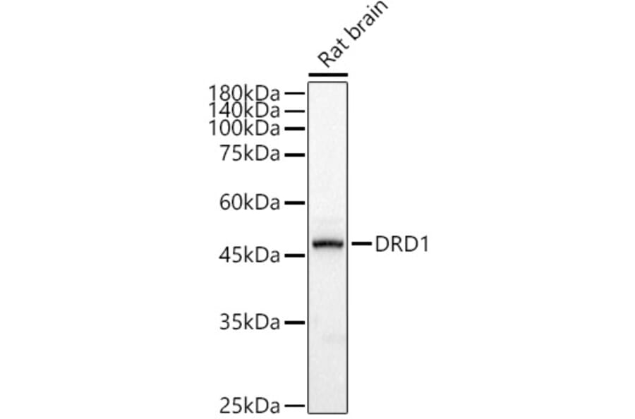 Western Blot - Anti-Dopamine Receptor D1 Antibody (A14240) - Antibodies.com