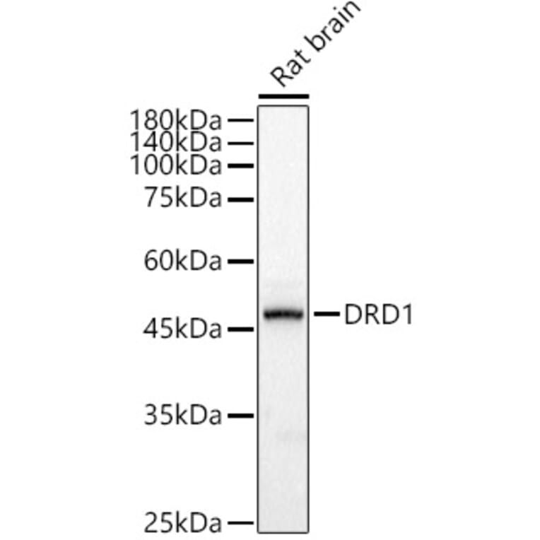 Western Blot - Anti-Dopamine Receptor D1 Antibody (A14240) - Antibodies.com