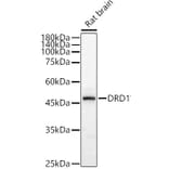 Western Blot - Anti-Dopamine Receptor D1 Antibody (A14240) - Antibodies.com