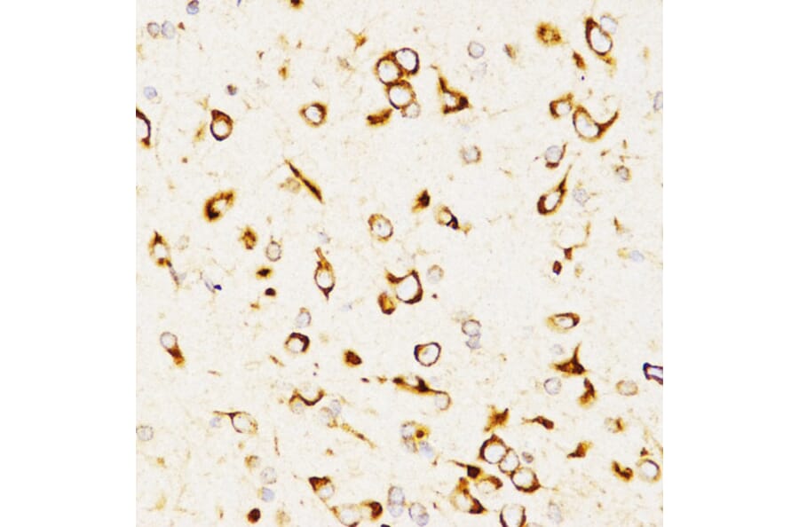 Immunohistochemistry - Anti-CD208 Antibody (A14241) - Antibodies.com
