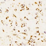 Immunohistochemistry - Anti-CD208 Antibody (A14241) - Antibodies.com